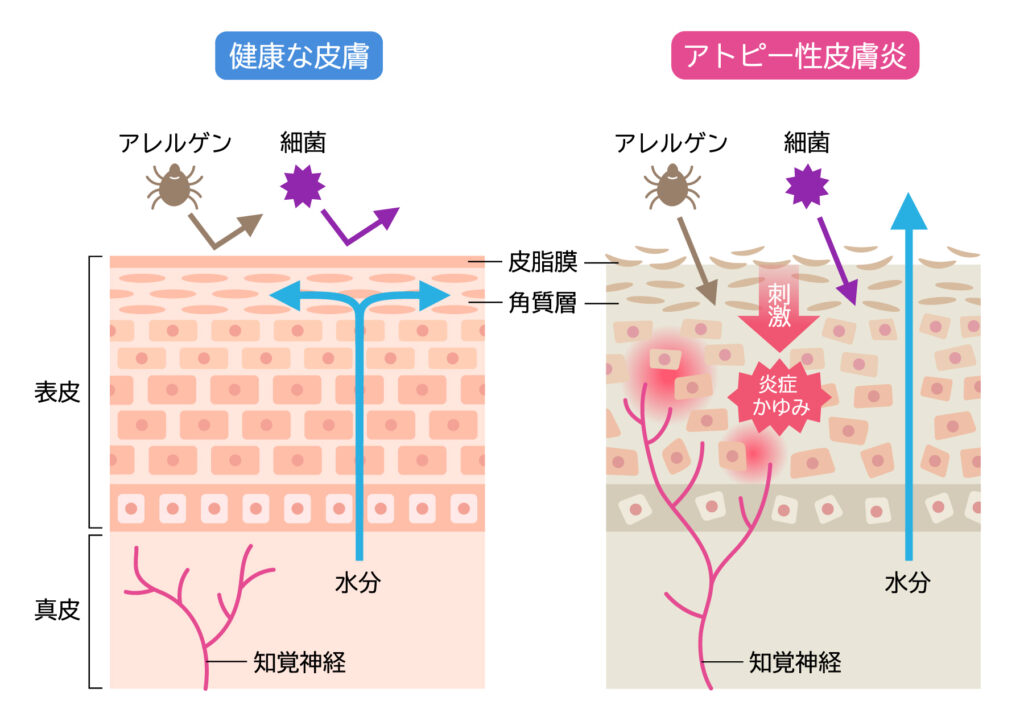 バリア機能解説